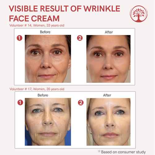AUROVA Botax Wrinkle Cream — Deep Hydration & Anti-Aging (50ml)