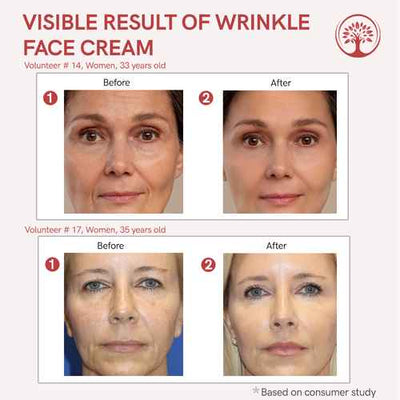 AUROVA Botax Wrinkle Cream — Deep Hydration & Anti-Aging (50ml)